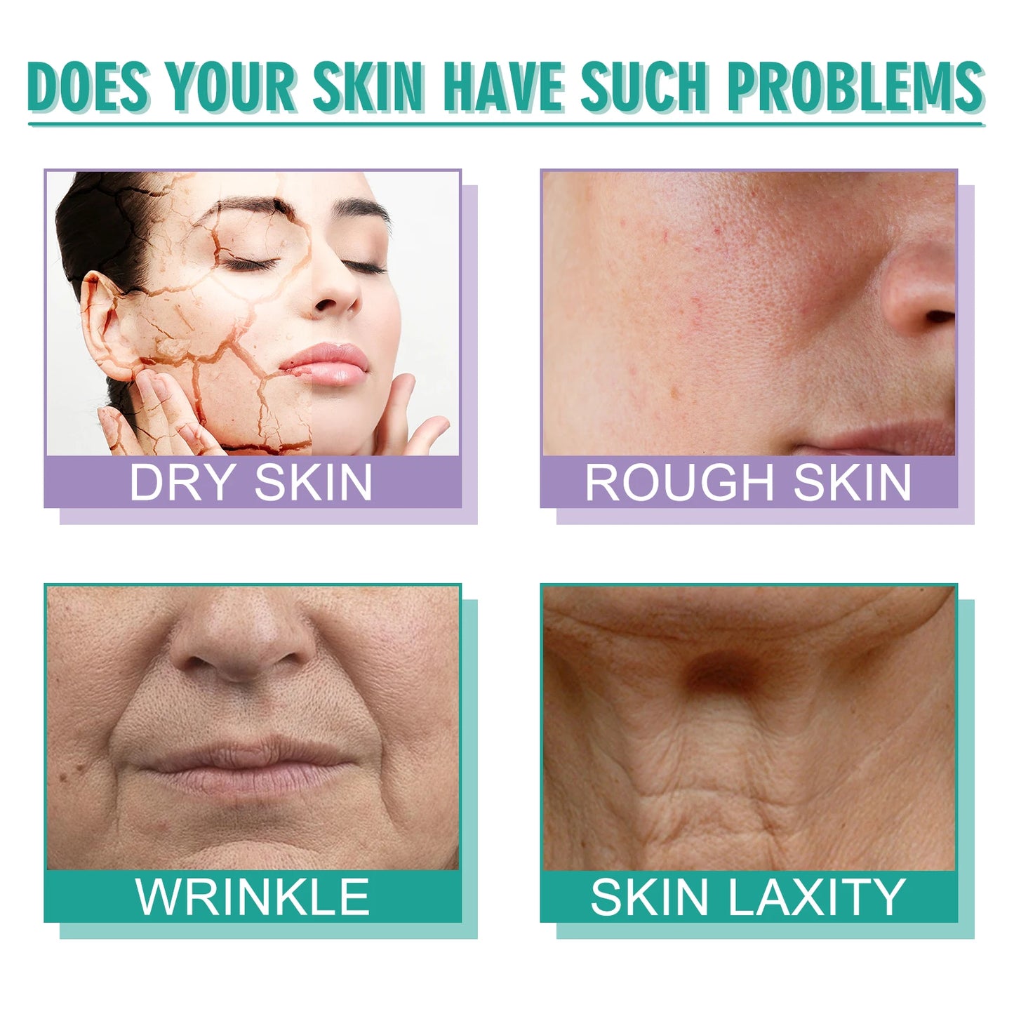 Hoygi Moisturizing Polypeptide Anti Aging Face Cream for Skin