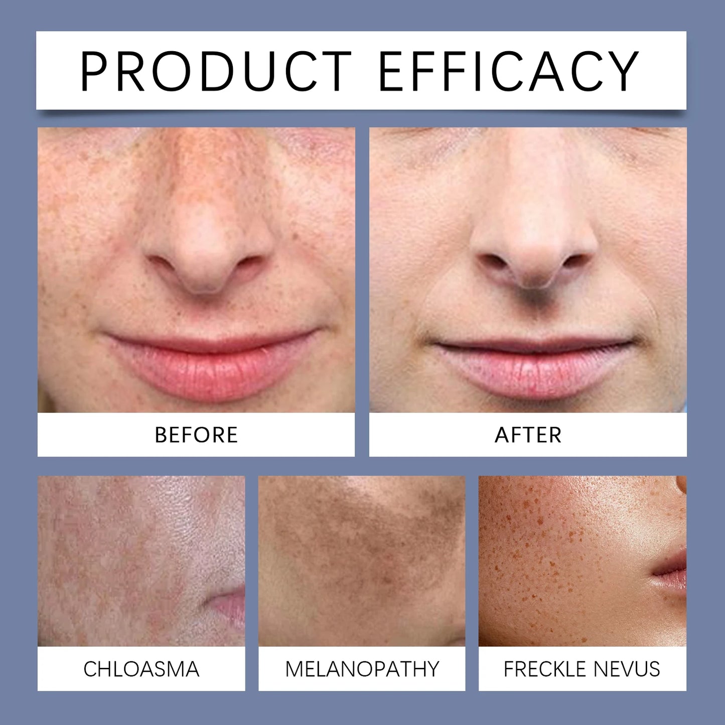 OUHOE Facial Cream for Spot Fading and Skin Brightening