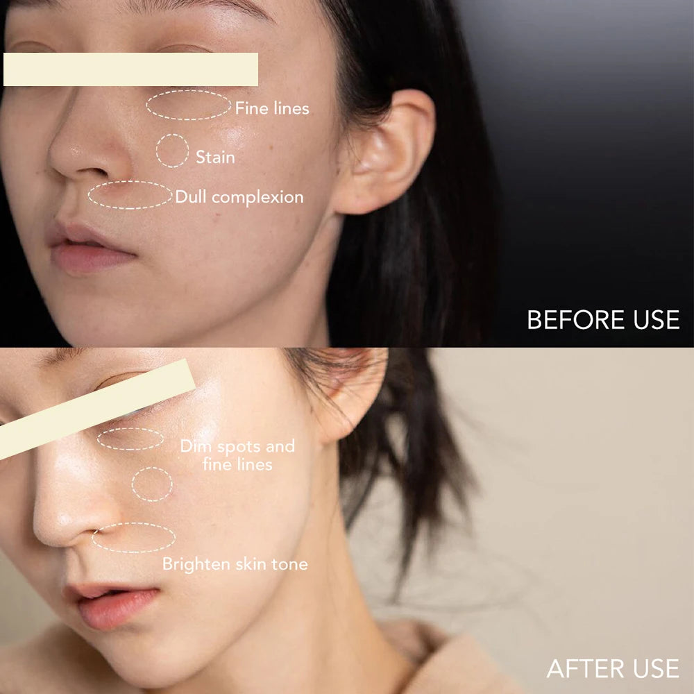 Ailke Dark Spot Corrector SPF 35 Facial Cream Brightening