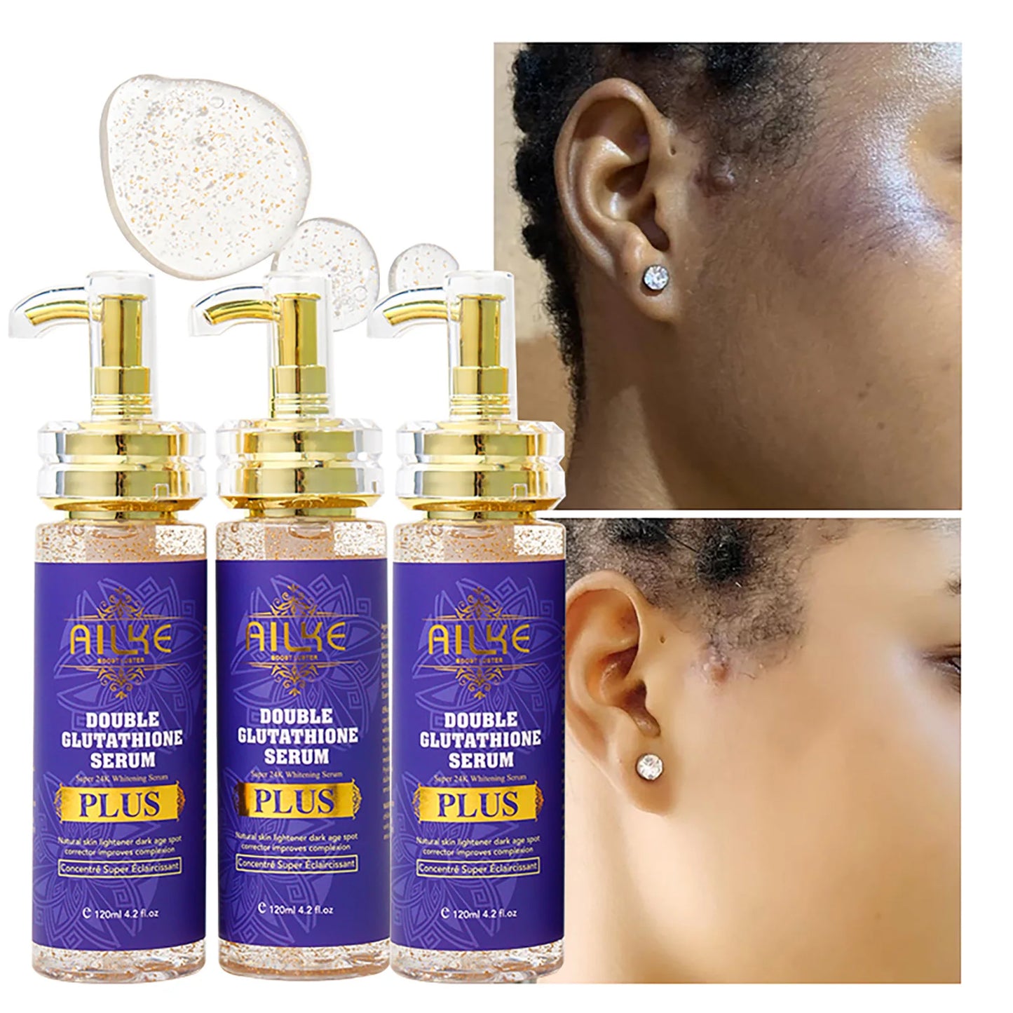 Ailke Whitening Serum For Face And Body Dark Spots