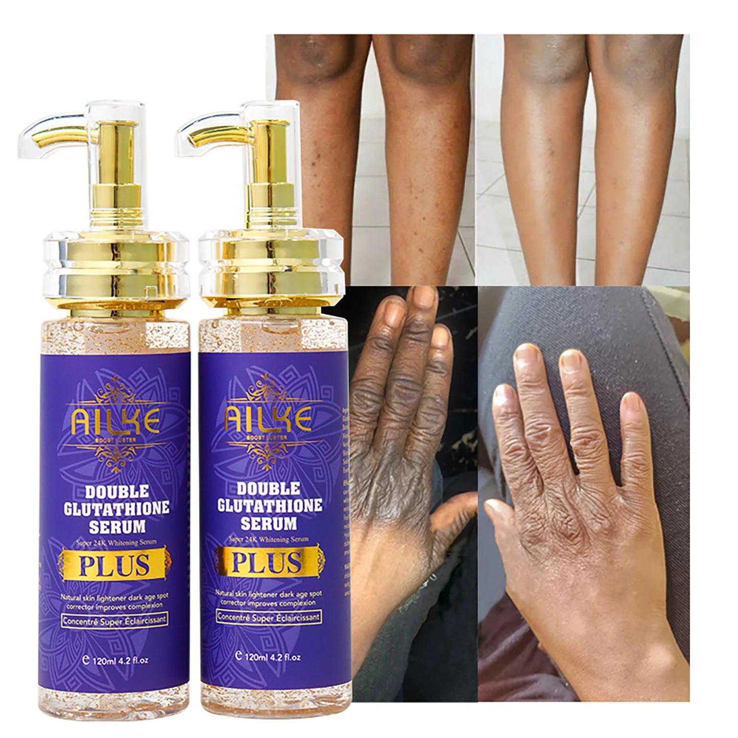 Ailke Whitening Serum For Face And Body Dark Spots