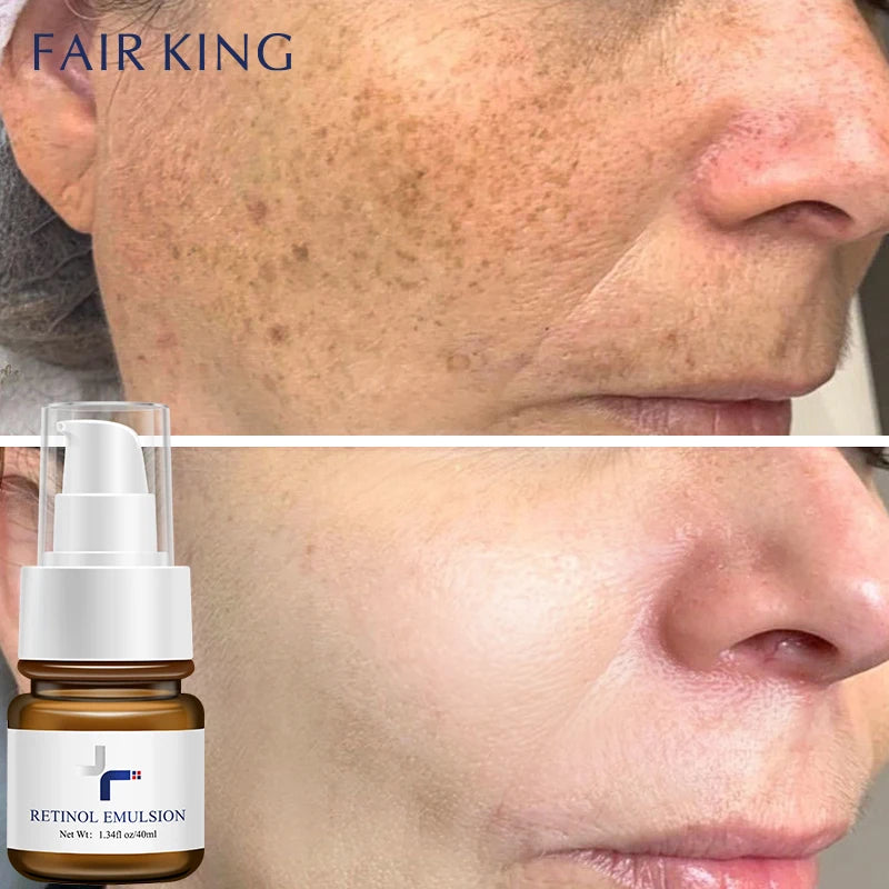 Retinol Anti Aging Facial Lotion for Youthful Skin
